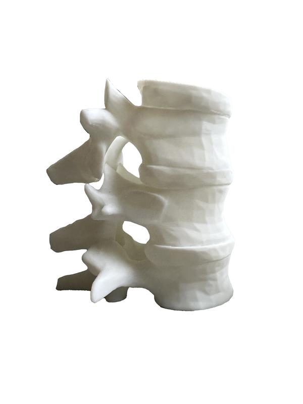 Spine Candle Holder - Tea Candle - 3 Spine Set